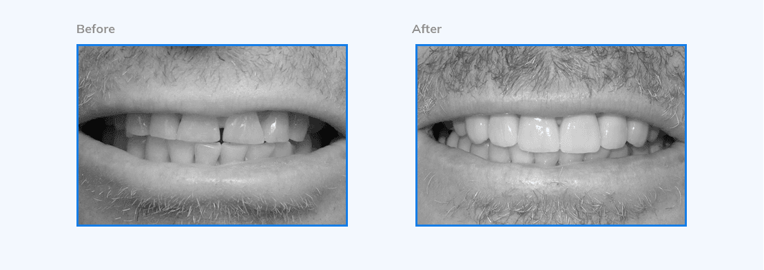 sparklesmiledentalcare