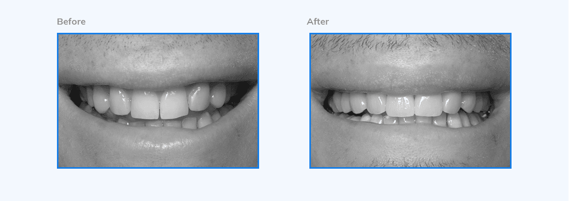 sparklesmiledentalcare