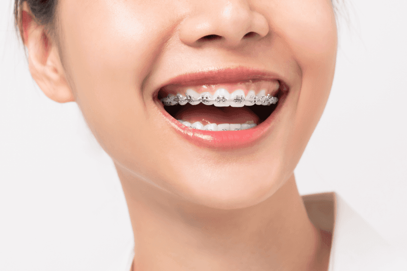 Orthodontics